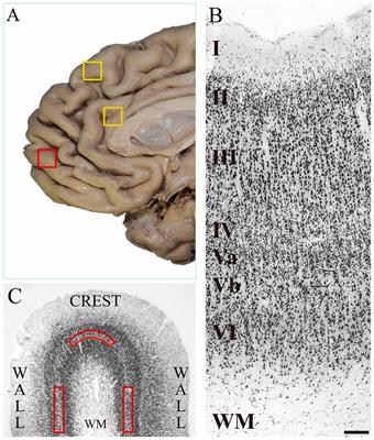 Von Economo Neurons in the Human Medial Frontopolar Cortex